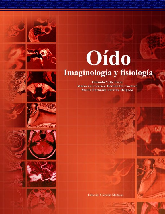 Oído. Imaginología y fisiología.